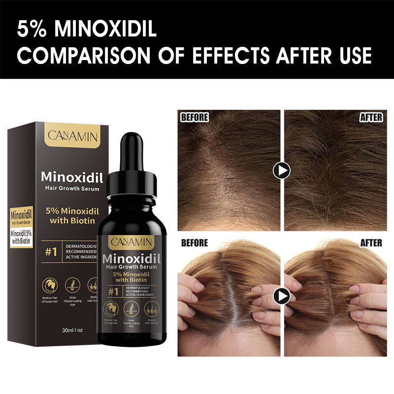 CANAMIN Minoxidil Serum 30ml