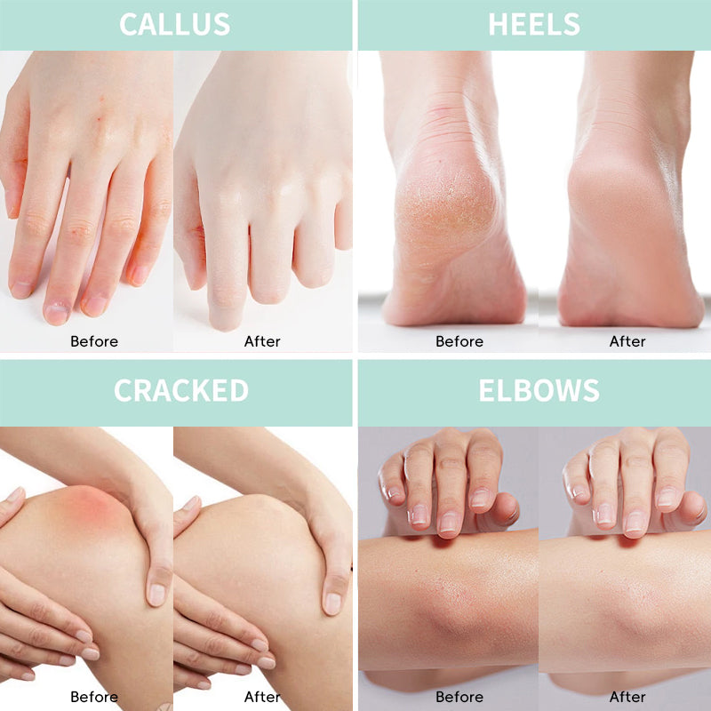 Tunmate Hand And Foot Urea Cream Color Box Edition 150g