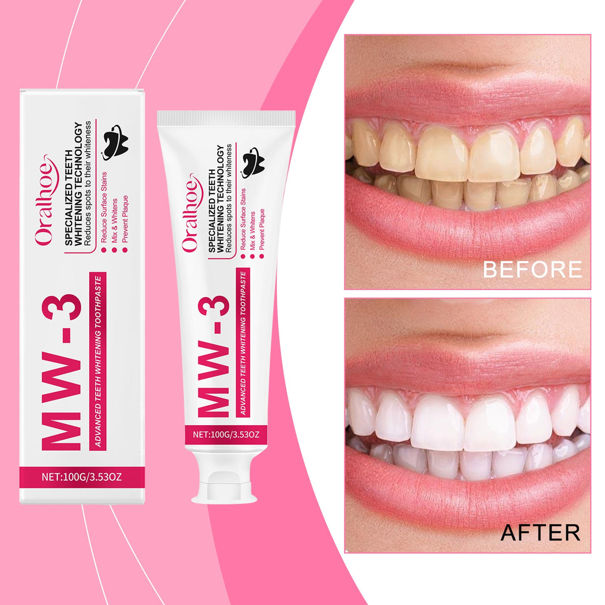 Whitening And Stain-removing Toothpaste