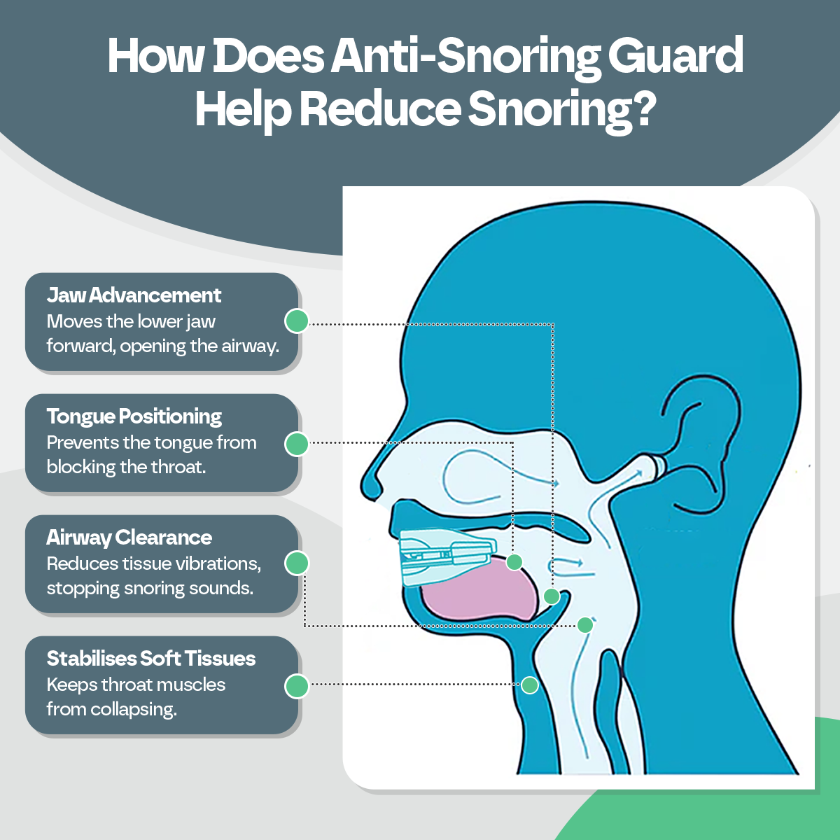 Anti-Snoring Mouth Guard – Adjustable Sleep Aid Mouthpiece