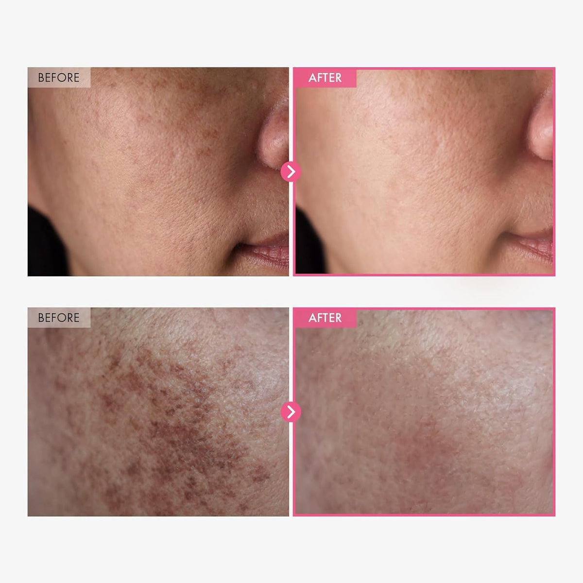 Arbutin Cream