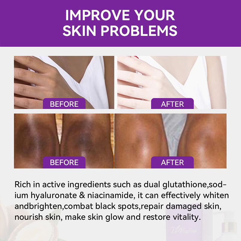 DR Double Glutathione Body Lotion