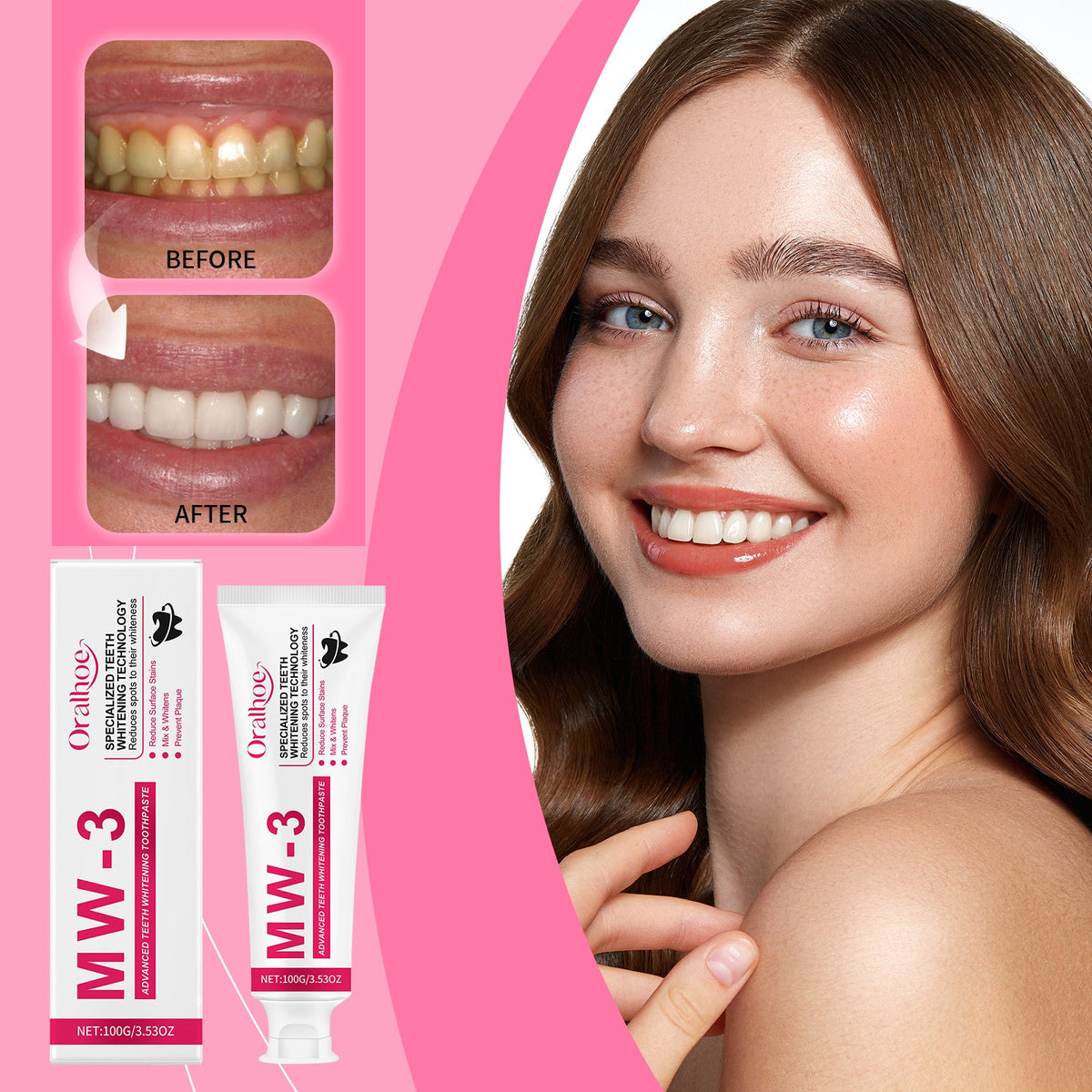 Whitening And Stain-removing Toothpaste
