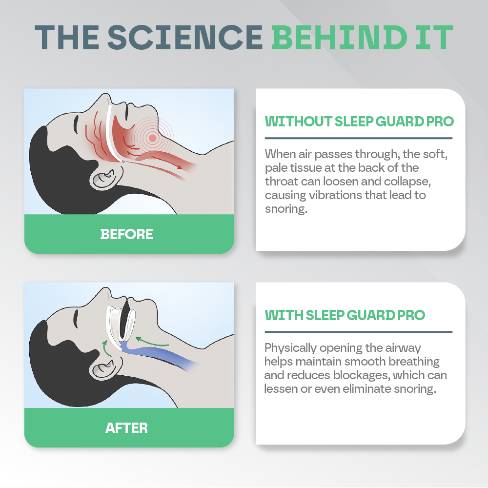 Sleep Guard Pro – Anti-Snore Mouth Guard for Restful Sleep