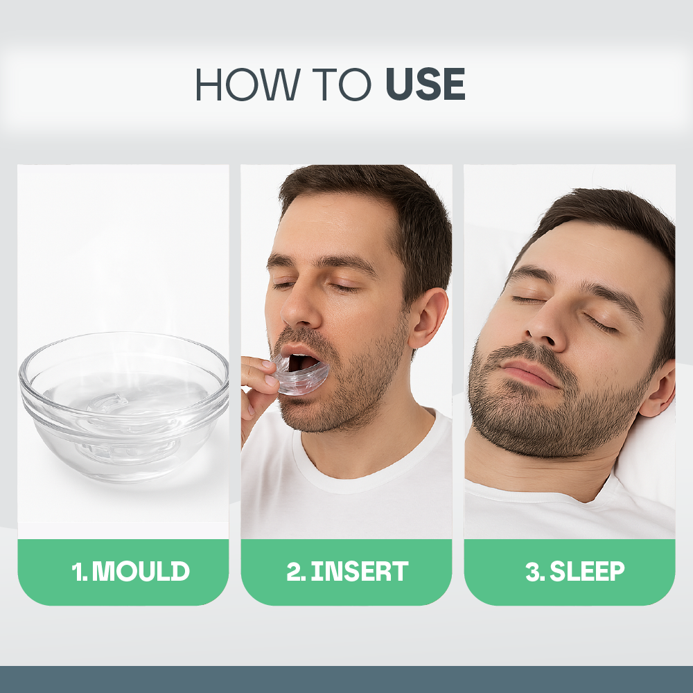 Sleep Guard Pro – Anti-Snore Mouth Guard for Restful Sleep