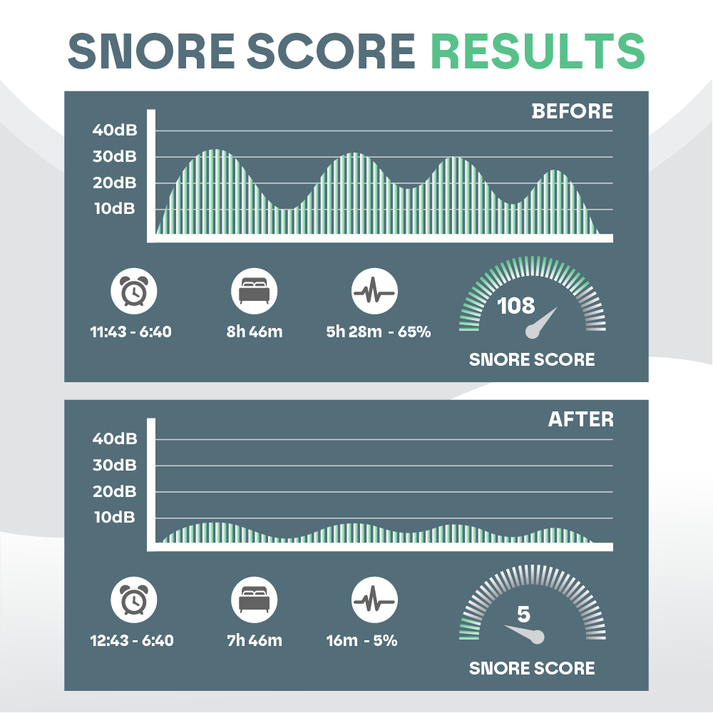 Sleep Guard Pro – Anti-Snore Mouth Guard for Restful Sleep